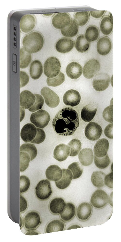 White Blood Cells Portable Battery Charger featuring the photograph Leukocyte, Drumstick, Lm #3 by Omikron