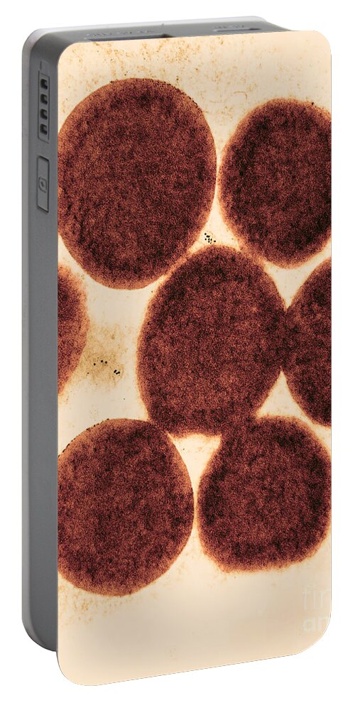 Medical Portable Battery Charger featuring the photograph Lipid Droplets Tem #3 by David M. Phillips