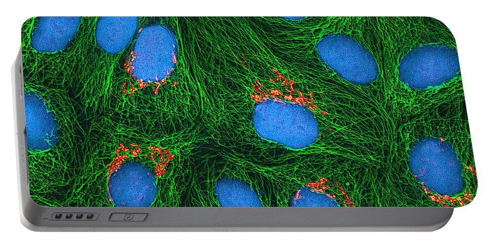 Science Portable Battery Charger featuring the photograph Hela Cells, Mfm #6 by Science Source