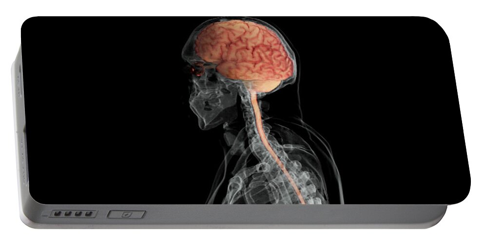 Anatomy Portable Battery Charger featuring the photograph Brain And Spinal Cord, Lateral View by Anatomical Travelogue