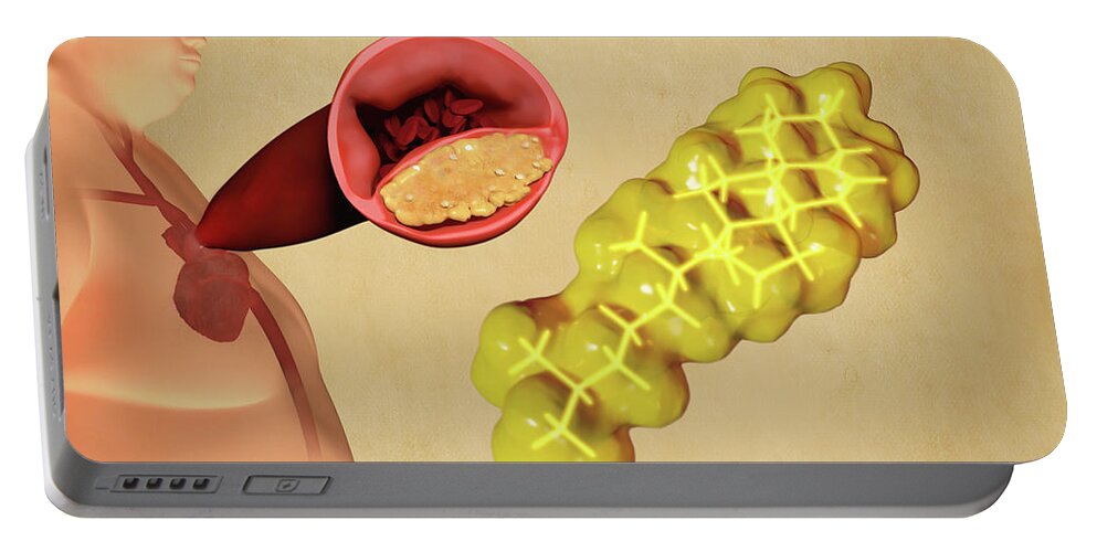 Art Portable Battery Charger featuring the photograph Cholesterol And Atherosclerosis, Artwork by Juan Gaertner