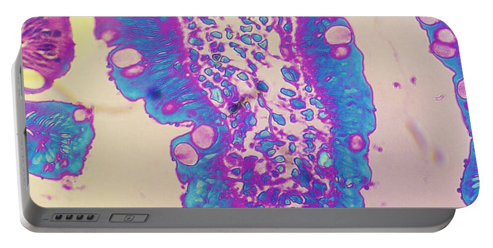 Histology Portable Battery Charger featuring the photograph Cryptosporidium In Intestine Of Baby by Dr. Cecil H. Fox