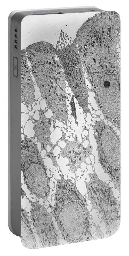 Biology Portable Battery Charger featuring the photograph Epithelial Cells Tem by Joseph F. Gennaro Jr.