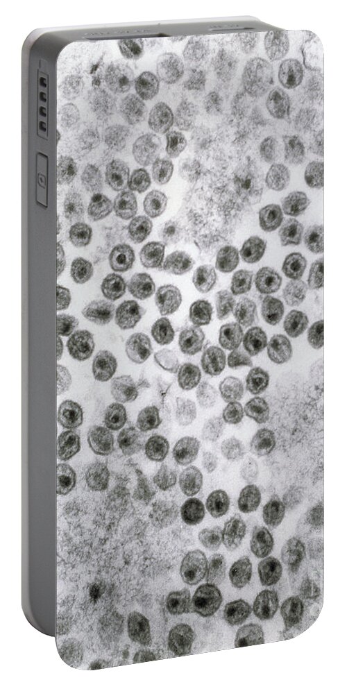 Hiv Portable Battery Charger featuring the photograph Hiv Virus by David M. Phillips