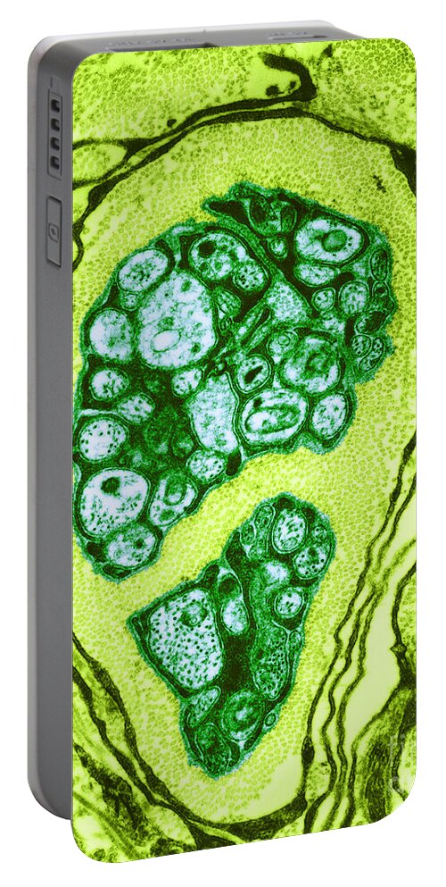 Microscopy Portable Battery Charger featuring the photograph Nerve Cell Axons, Tem by David M. Phillips