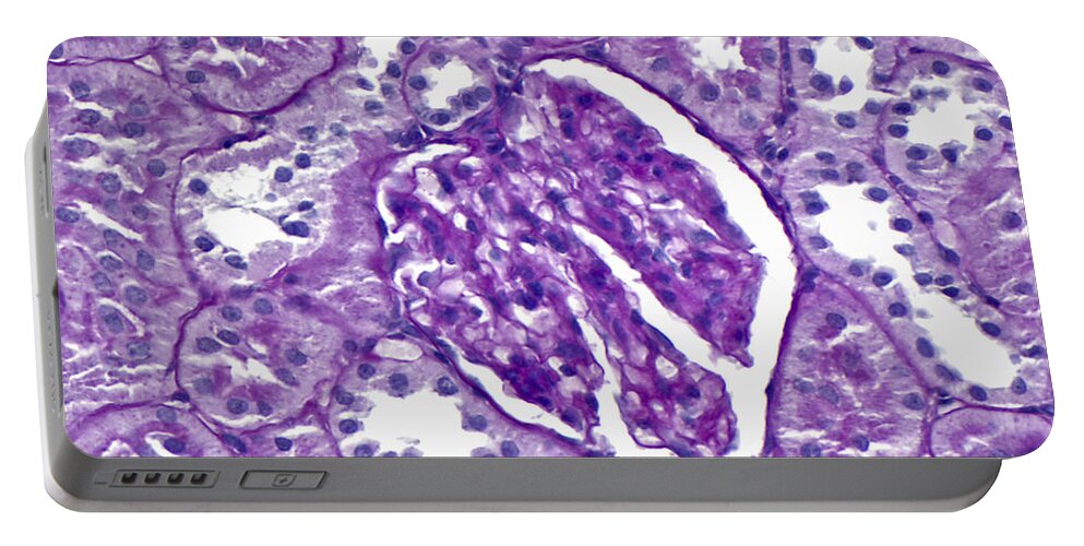 Kidney Portable Battery Charger featuring the photograph Renal Cortex Lm by Alvin Telser