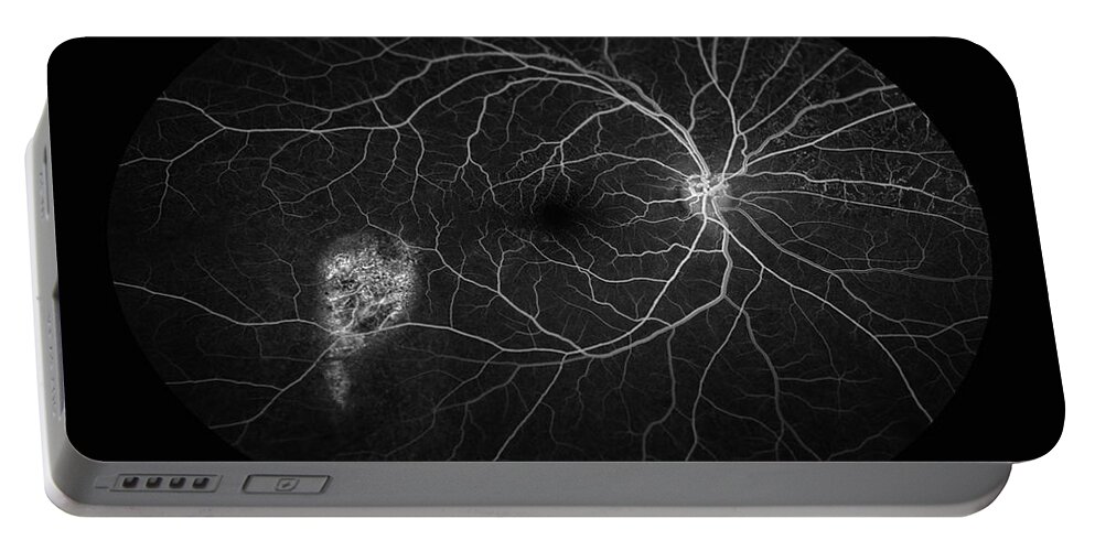 Abnormal Portable Battery Charger featuring the photograph Window Defect, Ophthalmic Medicine by Paul Whitten