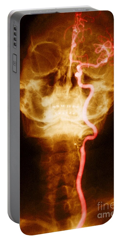 Artery Portable Battery Charger featuring the photograph Blood Supply Of Head And Neck #1 by Science Source