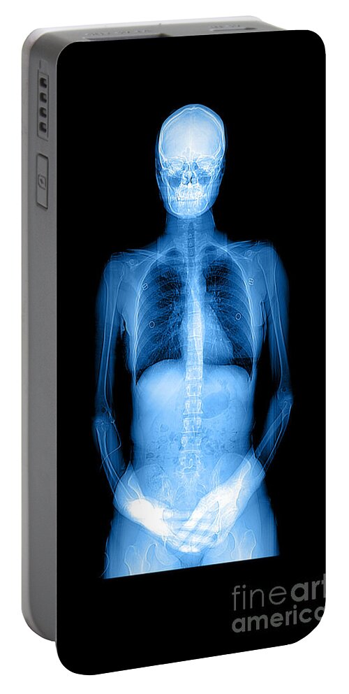 Cat Scan Portable Battery Charger featuring the photograph Human Body X-ray And Ct #1 by Medical Body Scans