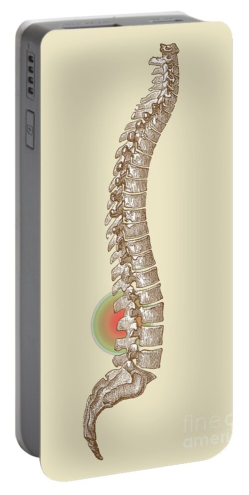 Ache Portable Battery Charger featuring the photograph Lower Back Pain #1 by Science Source