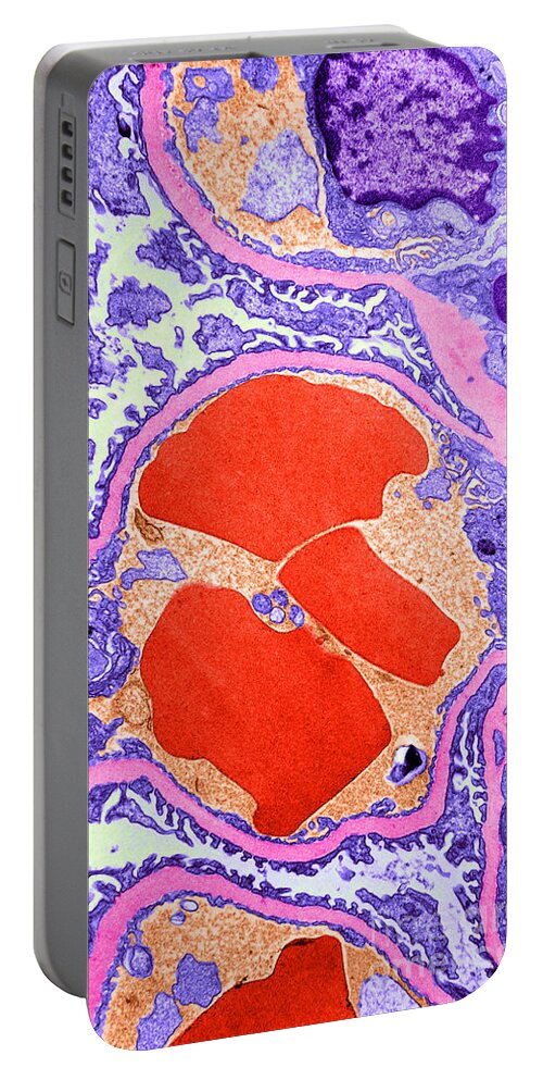 Cell Portable Battery Charger featuring the photograph Tem Of Glomerulus Capillary Loop #1 by W. Rosenberg