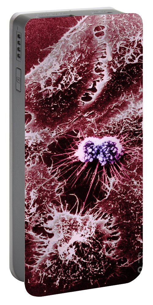 Adenovirus Portable Battery Charger featuring the photograph Hela Cells With Adenovirus #2 by Science Source