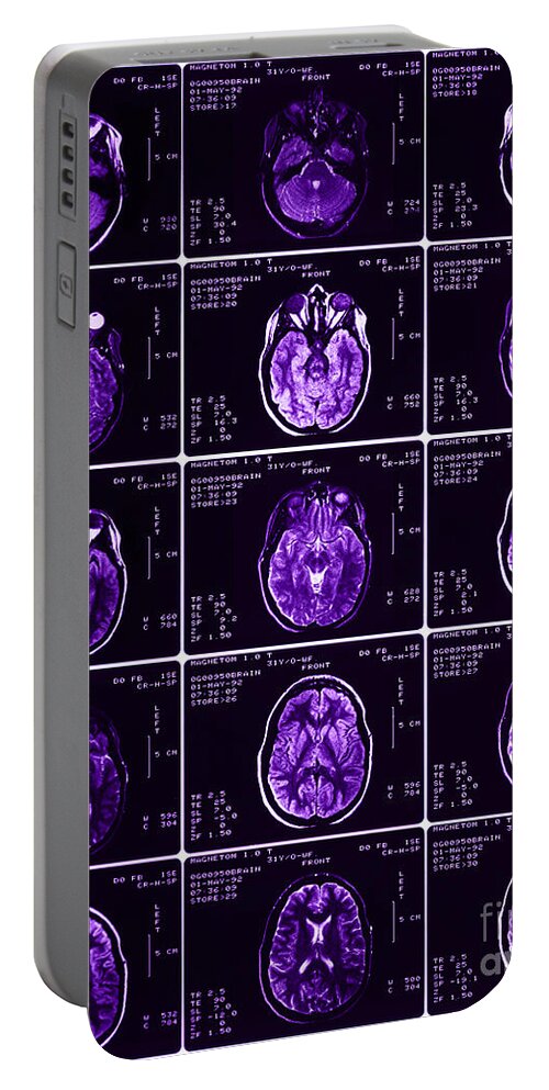 Brain Portable Battery Charger featuring the photograph Mri Of Normal Brain #27 by Science Source