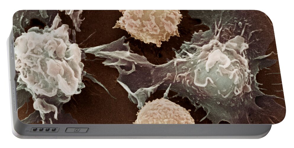 Cancer Portable Battery Charger featuring the photograph Cancer Cells #5 by Science Source