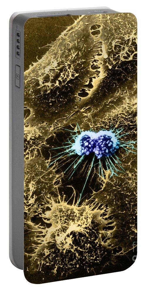 Sem Portable Battery Charger featuring the photograph Hela Cells With Adenovirus #4 by Science Source