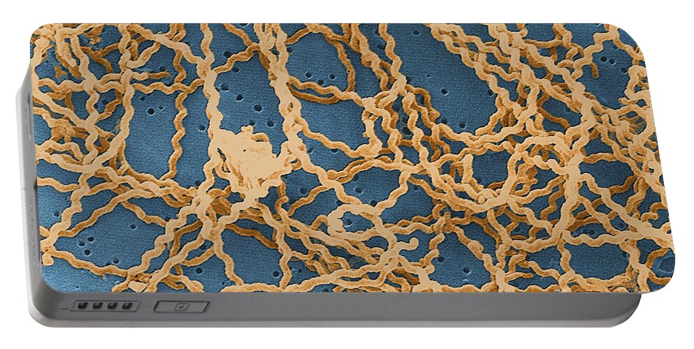 Spirochete Portable Battery Charger featuring the photograph Leptospira by Science Source