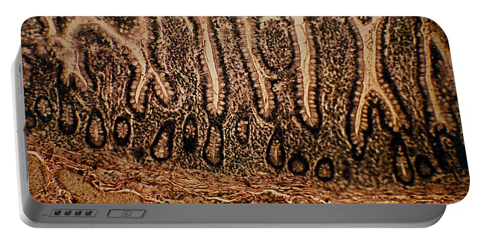 Columnar Cell Portable Battery Charger featuring the photograph Lm Of A Section Through The Human by Eric Grave