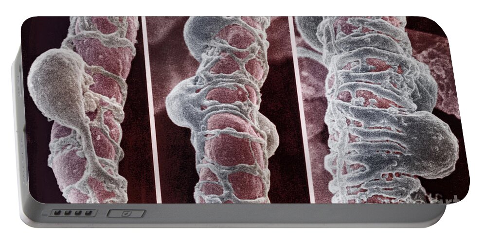 Blood Portable Battery Charger featuring the photograph Pericytes by Science Source