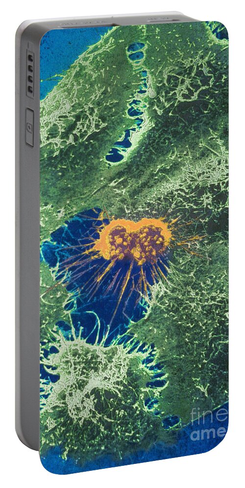 Adenovirus Portable Battery Charger featuring the photograph Sem, Hela Cells With Adenovirus by Science Source