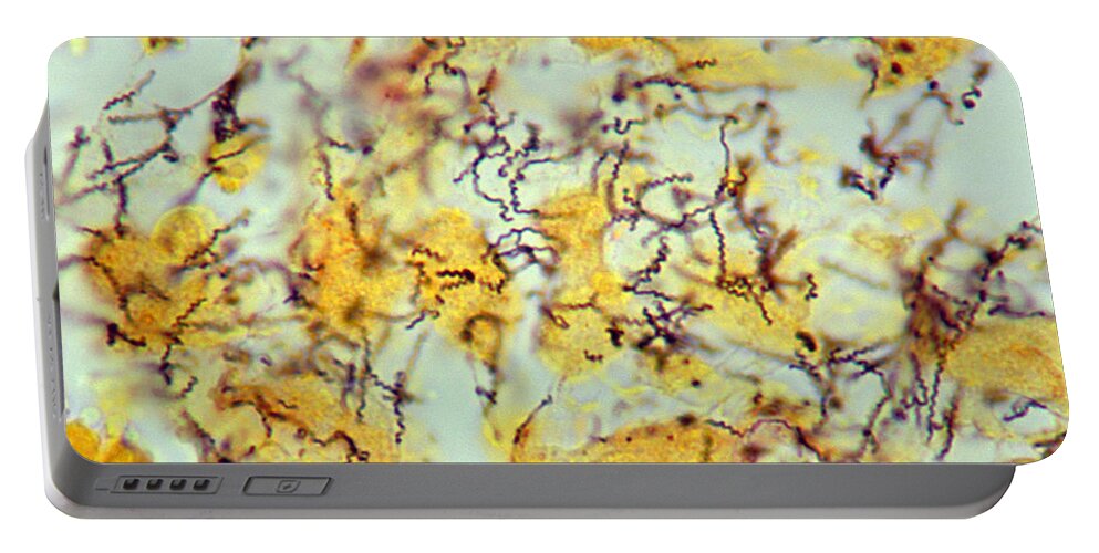 Treponema Pallidum Portable Battery Charger featuring the photograph Treponema Pallidum Spirochetes by Science Source