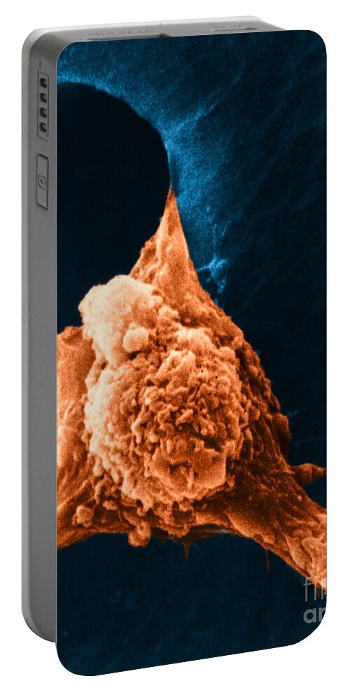 Sem Portable Battery Charger featuring the photograph Metastasis #3 by Science Source