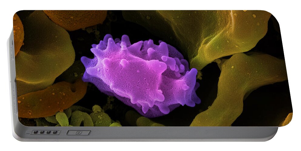 Lymphocyte Portable Battery Charger featuring the photograph Human Lymphocyte Cell, Sem #5 by Ted Kinsman