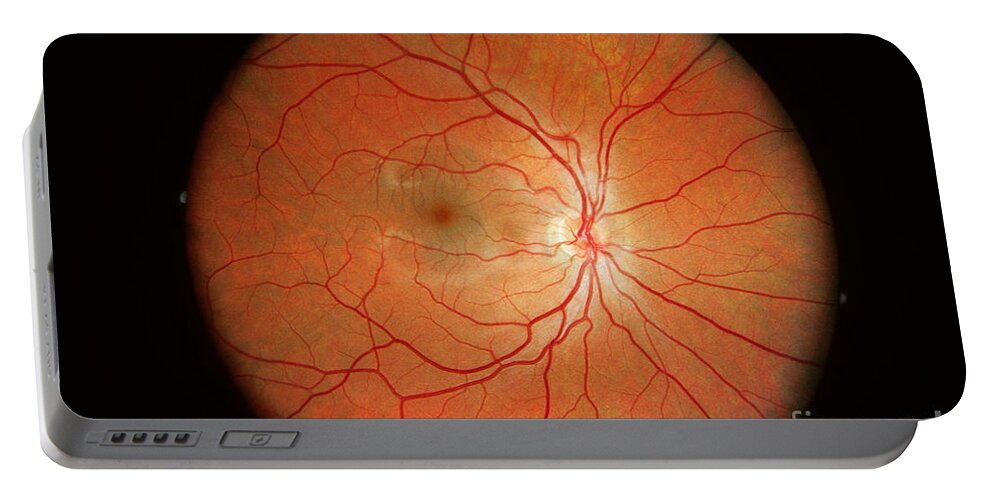 Blood Vessels Portable Battery Charger featuring the photograph Normal Retina by Science Source