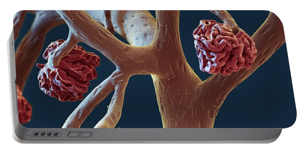Capillary Portable Battery Charger featuring the photograph Glomeruli And Capillaries, Sem by Oliver Meckes EYE OF SCIENCE
