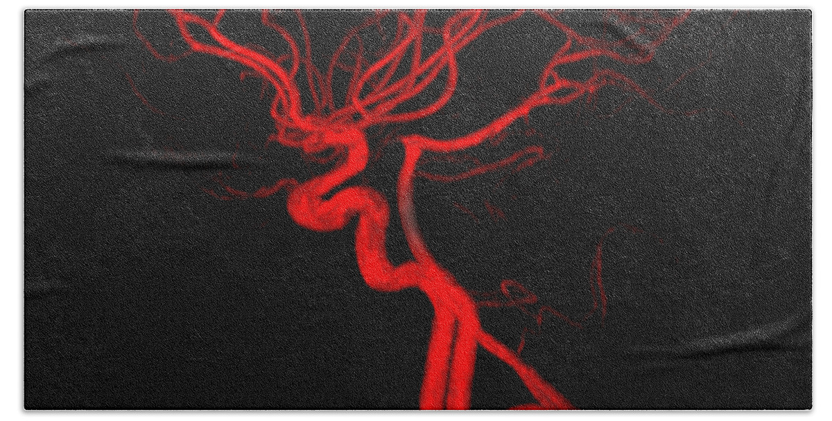 Intracranial Mra Beach Towel featuring the photograph Normal Intracranial Mra #2 by Living Art Enterprises