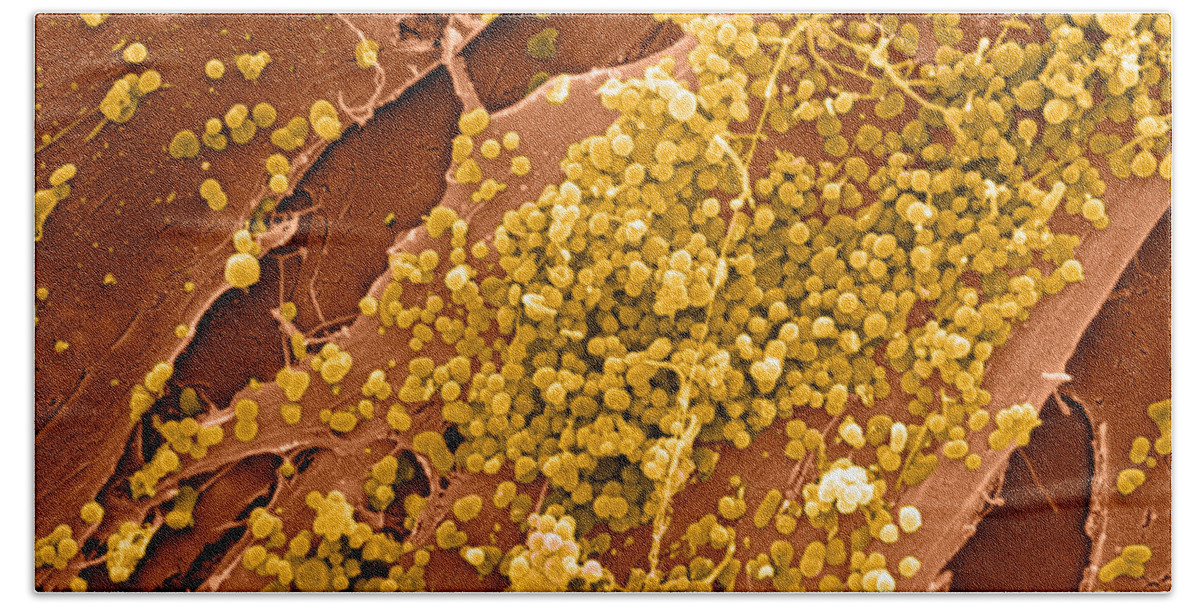 Cell Beach Towel featuring the photograph Human Skin Cell Sem by David M. Phillips