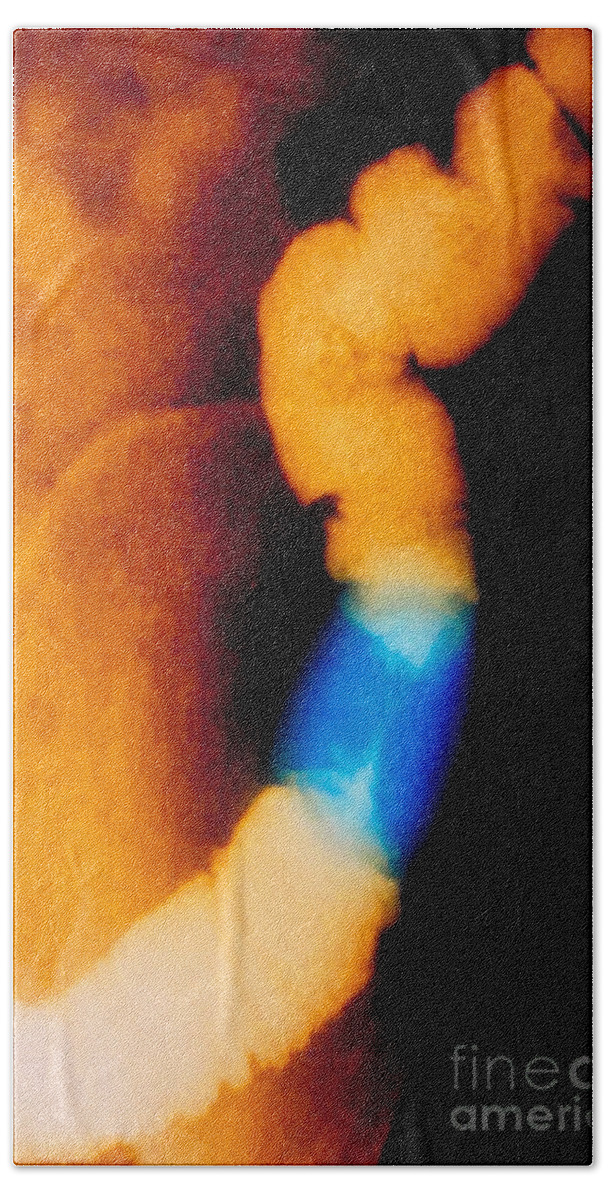 Enhanced Beach Towel featuring the photograph Abdomen X-ray Of Colon Cancer by Scott Camazine & Sue Trainor