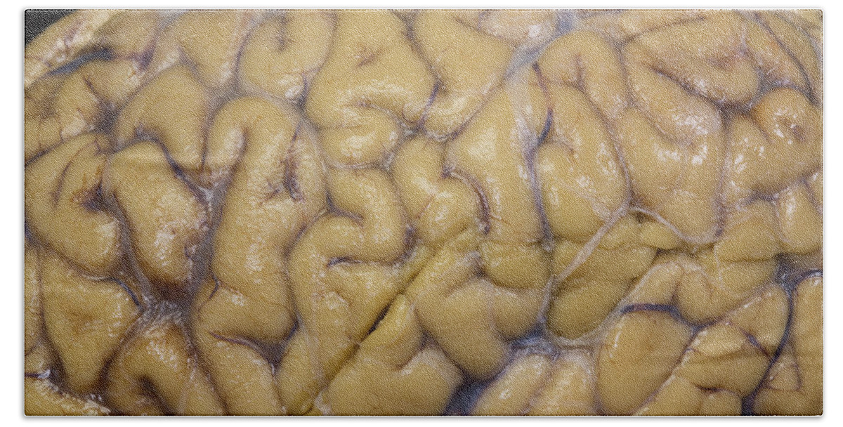Close-up Beach Towel featuring the photograph Close-up Of Human Brain by Science Stock Photography