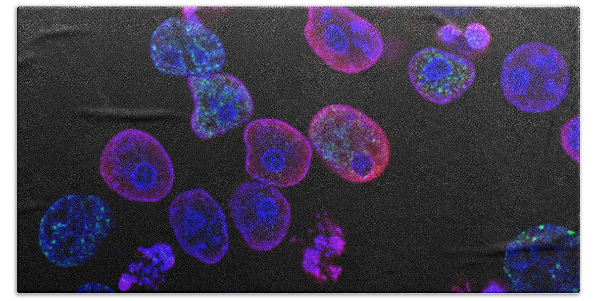 Science Beach Towel featuring the photograph Colorectal Cancer Cells Damaged By Atr by Science Source