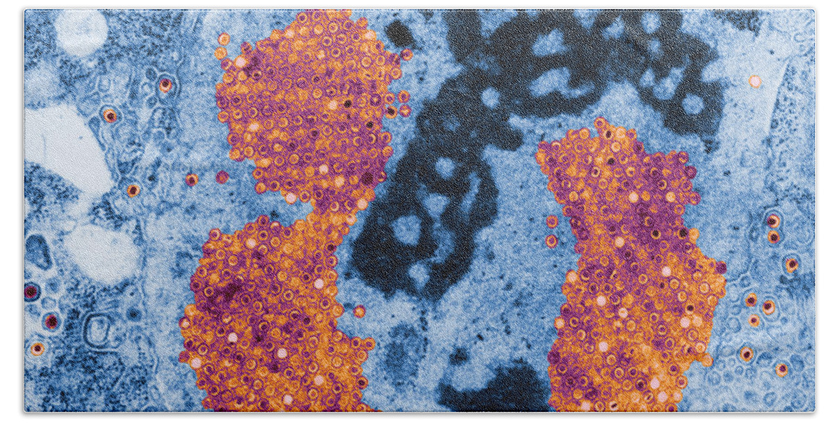 Electron Micrograph Beach Towel featuring the photograph Herpes Simplex Virus #2 by Science Source