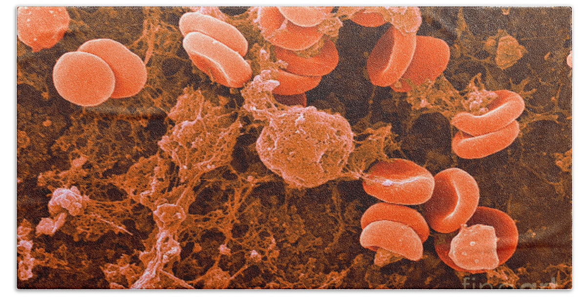 Biology Beach Towel featuring the photograph Red Blood Cells, Rouleaux Formation, Sem #2 by Science Source