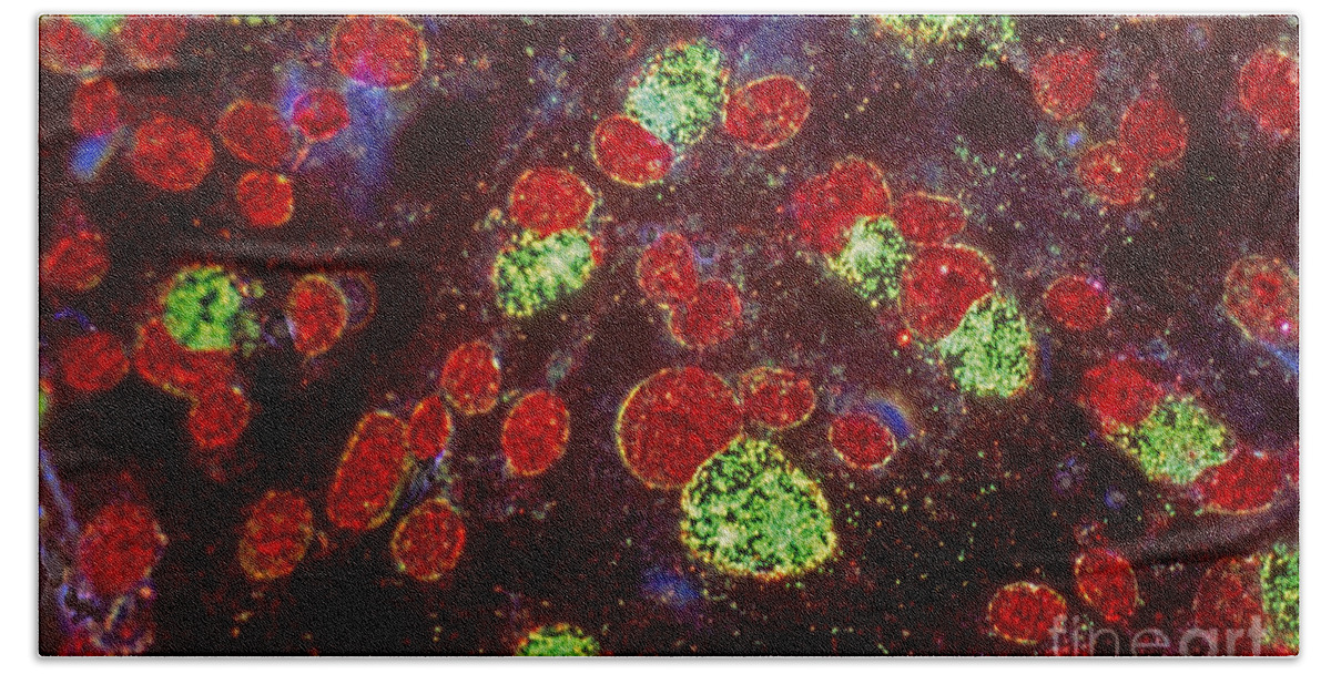 Micrography Beach Towel featuring the photograph Chlamydia Infected Culture by M I Walker