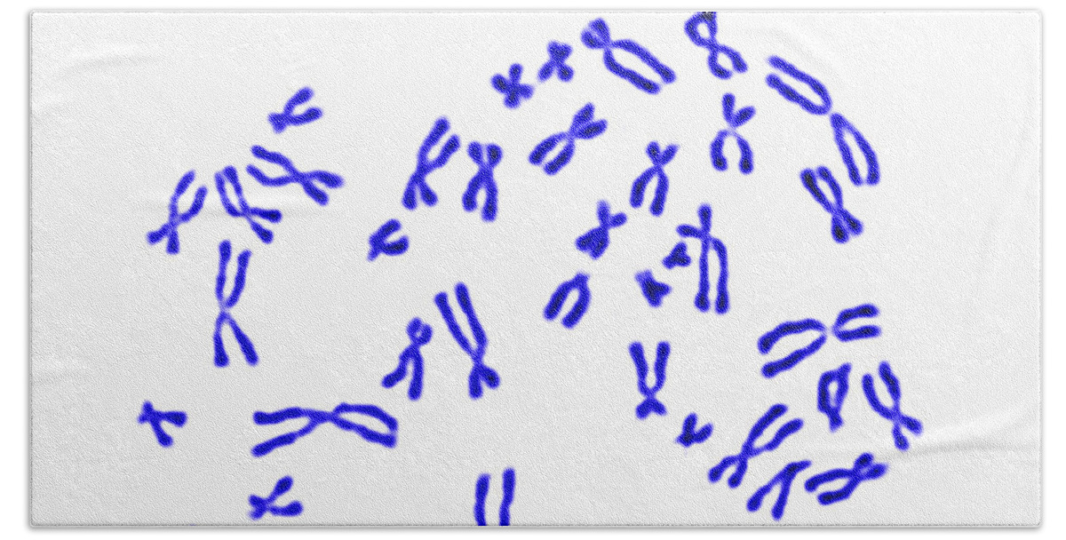 Chromosome Beach Sheet featuring the photograph Male Karyotype by Science Source