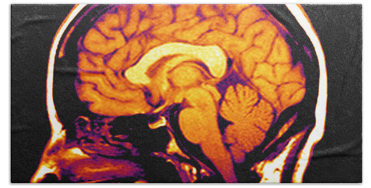 Brain Beach Towel featuring the photograph Mri Of Brain #3 by Medical Body Scans
