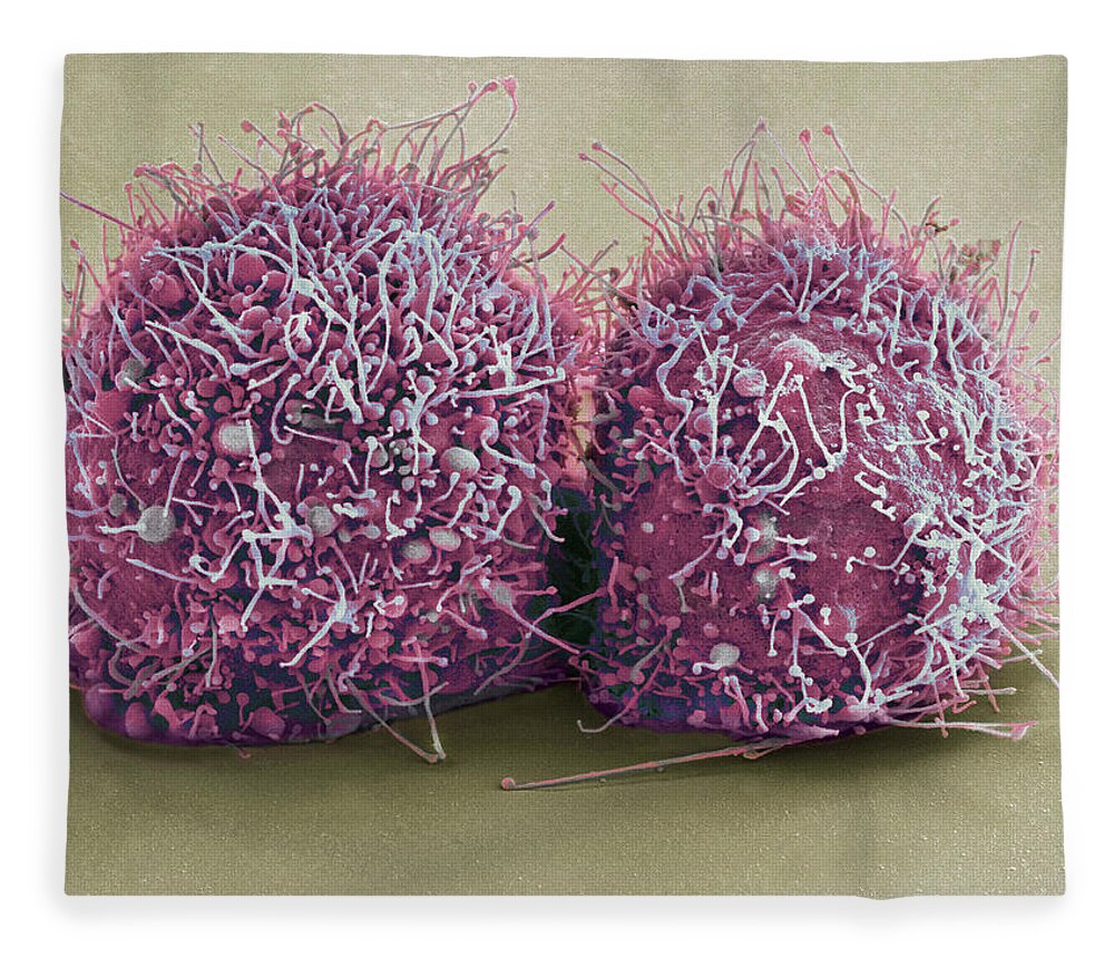 Science Fleece Blanket featuring the photograph Dividing Hela Cells, Sem by Science Source