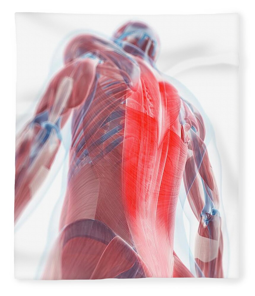 Physiology Fleece Blanket featuring the digital art Back Pain, Conceptual Artwork by Sciepro