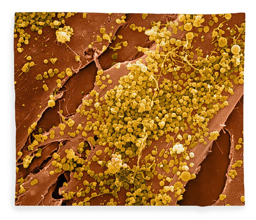 Cell Fleece Blanket featuring the photograph Human Skin Cell Sem by David M. Phillips