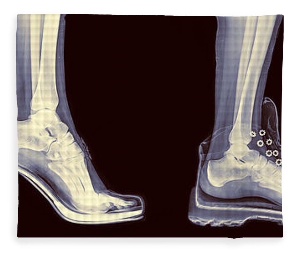 Ankle Fleece Blanket featuring the photograph Different Shoes X-ray by Guy Viner