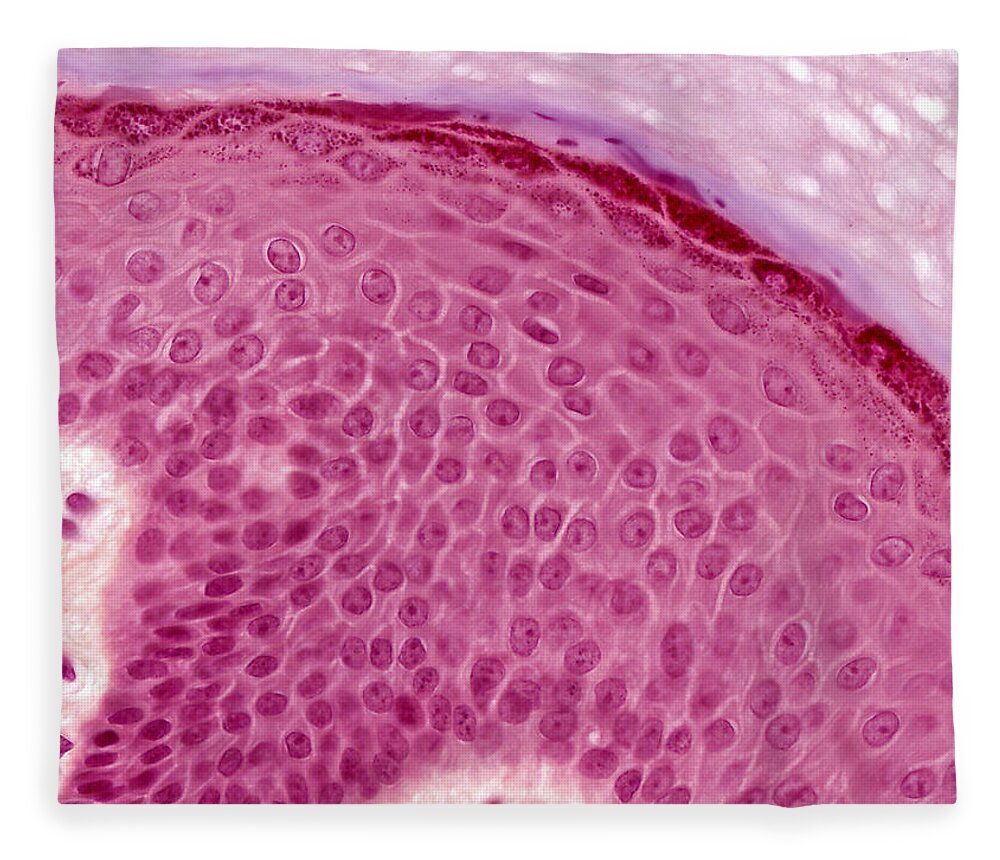 Skin Fleece Blanket featuring the photograph Epidermis Lm by Alvin Telser