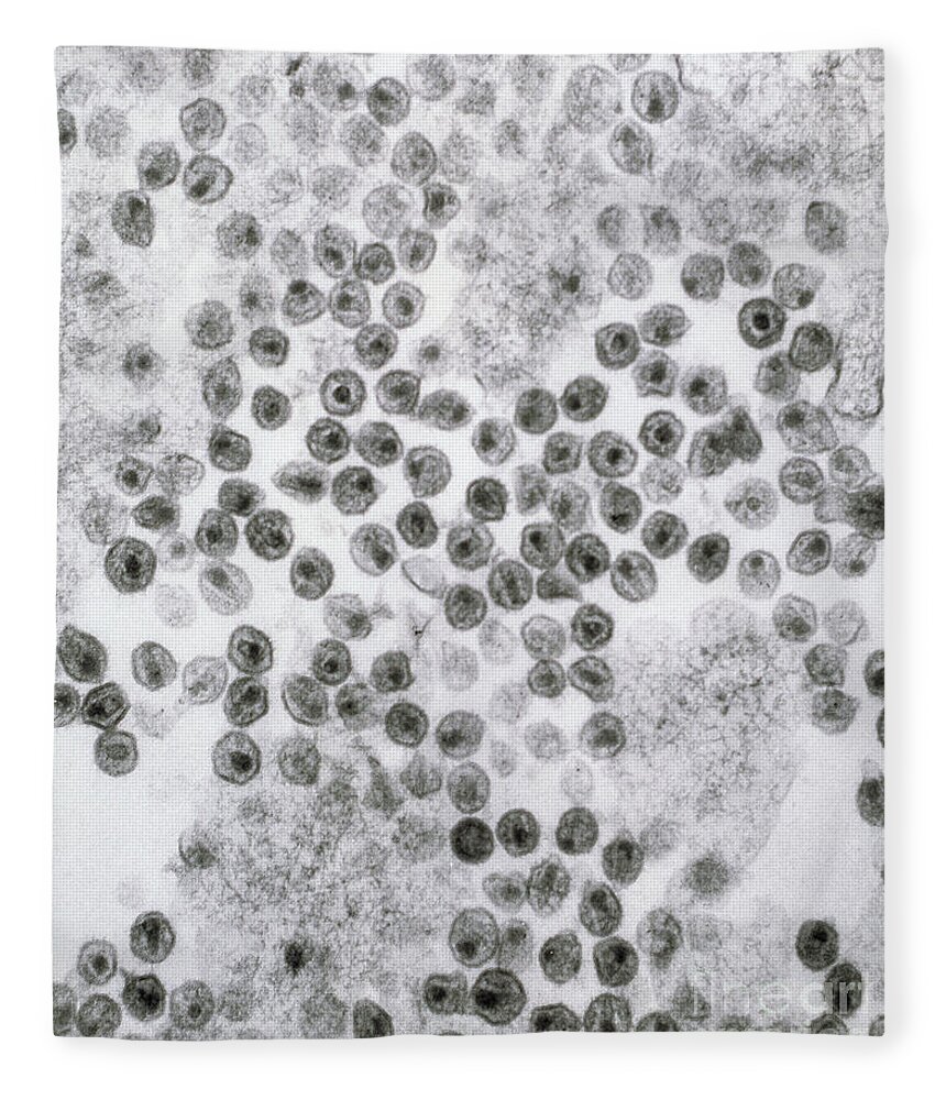 Hiv Fleece Blanket featuring the photograph Hiv Virus by David M. Phillips