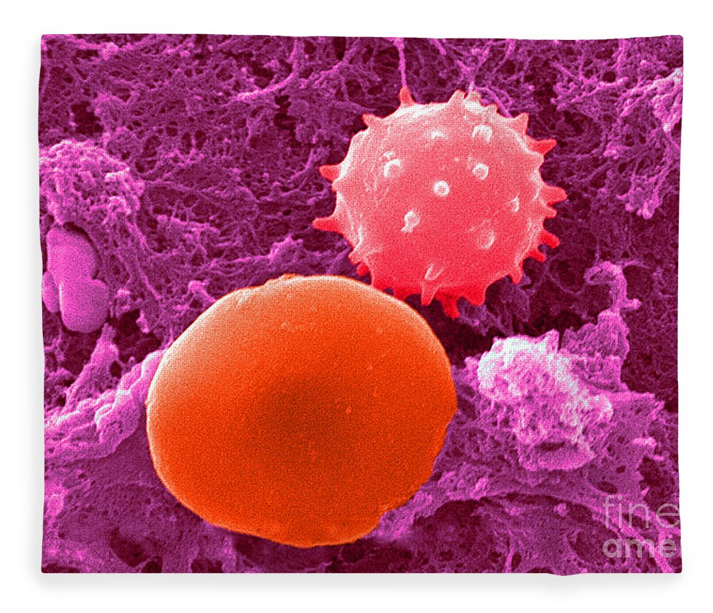 Biology Fleece Blanket featuring the photograph Red And White Blood Cells, Sem #2 by Science Source