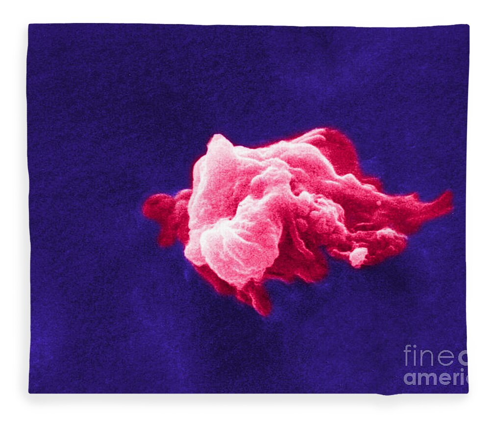 Scanning Electron Micrograph Fleece Blanket featuring the photograph Cancer Cell Death, Sem 6 Of 6 #1 by Science Source