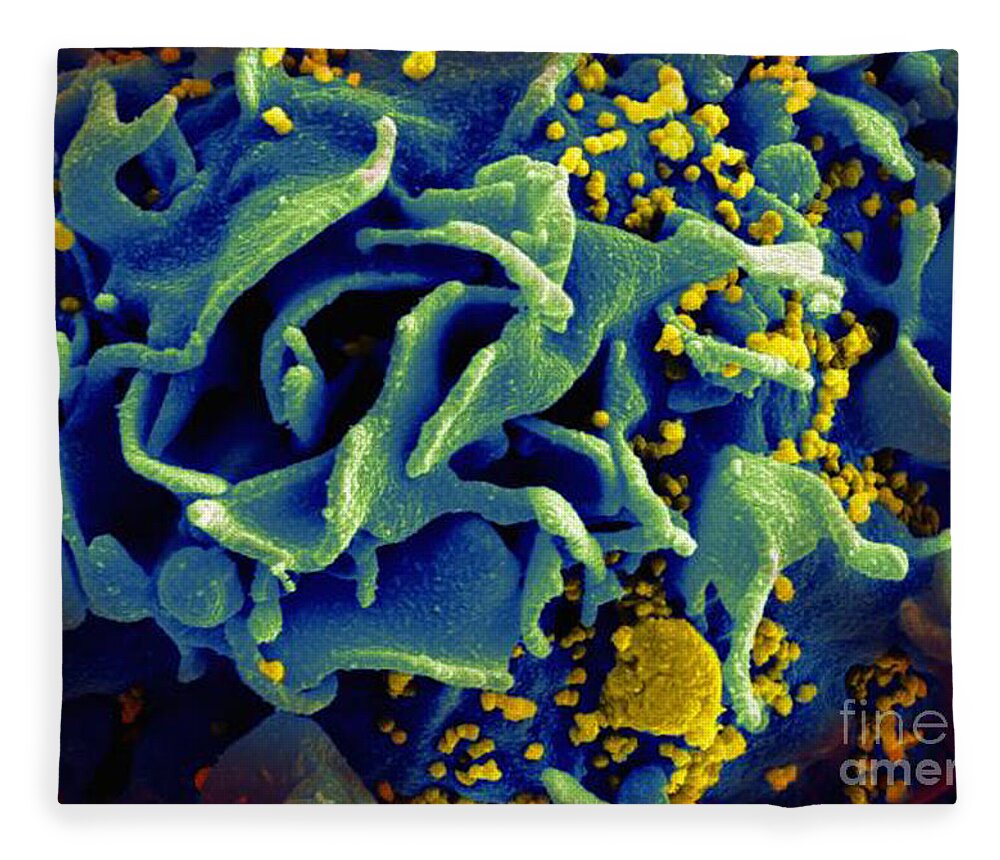 Microbiology Fleece Blanket featuring the photograph Hiv-infected T Cell, Sem by Science Source