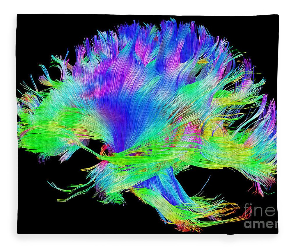 Brain Mri Fleece Blanket featuring the photograph Fiber Tracts Of The Brain, Dti by Living Art Enterprises