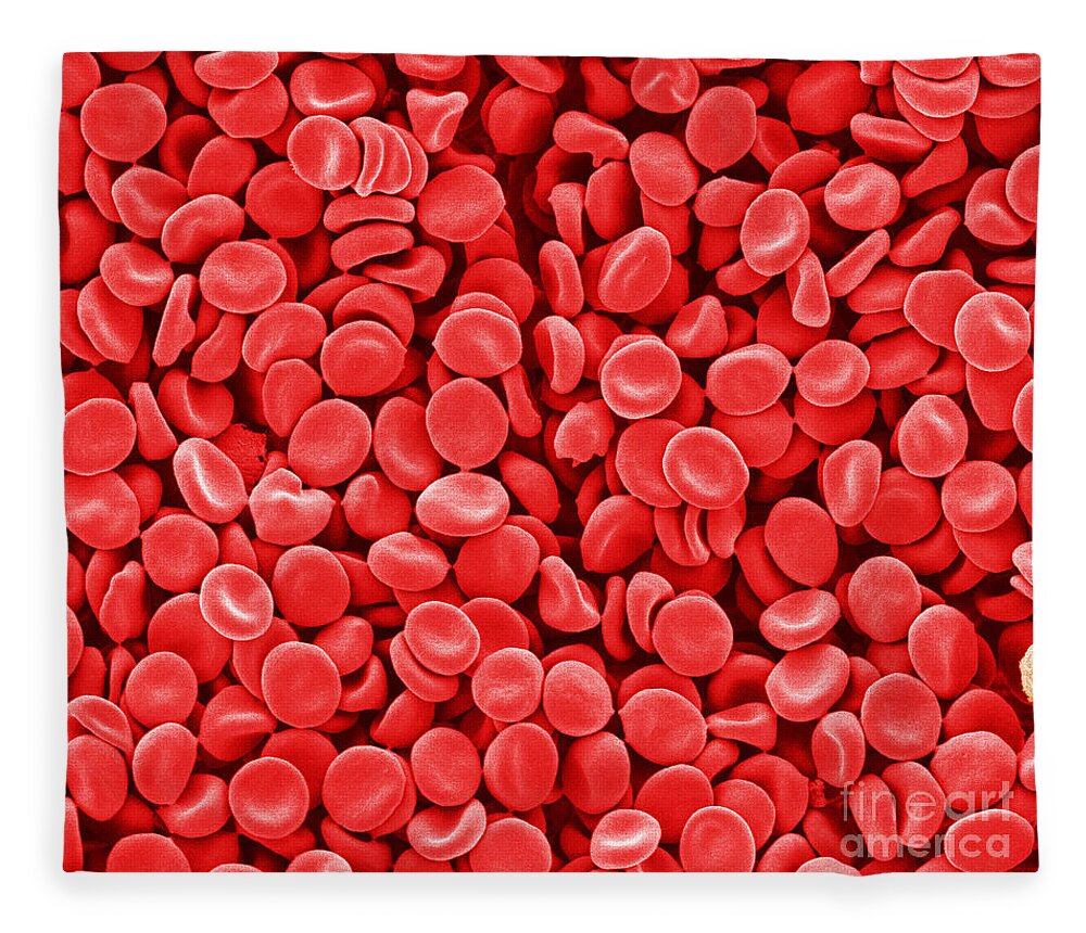 Red Blood Cells Fleece Blanket featuring the photograph Red Blood Cells, Sem by Scimat