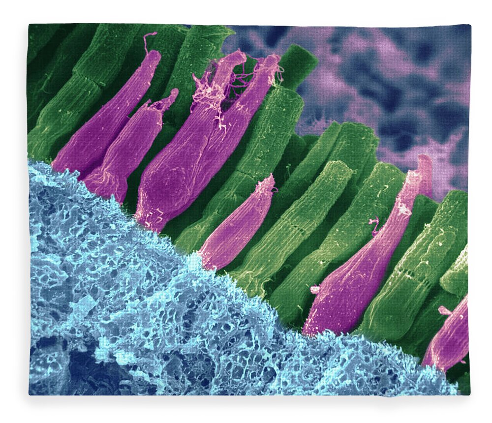 Scanning Electron Micrograph Fleece Blanket featuring the photograph Rods And Cones In Retina by Omikron